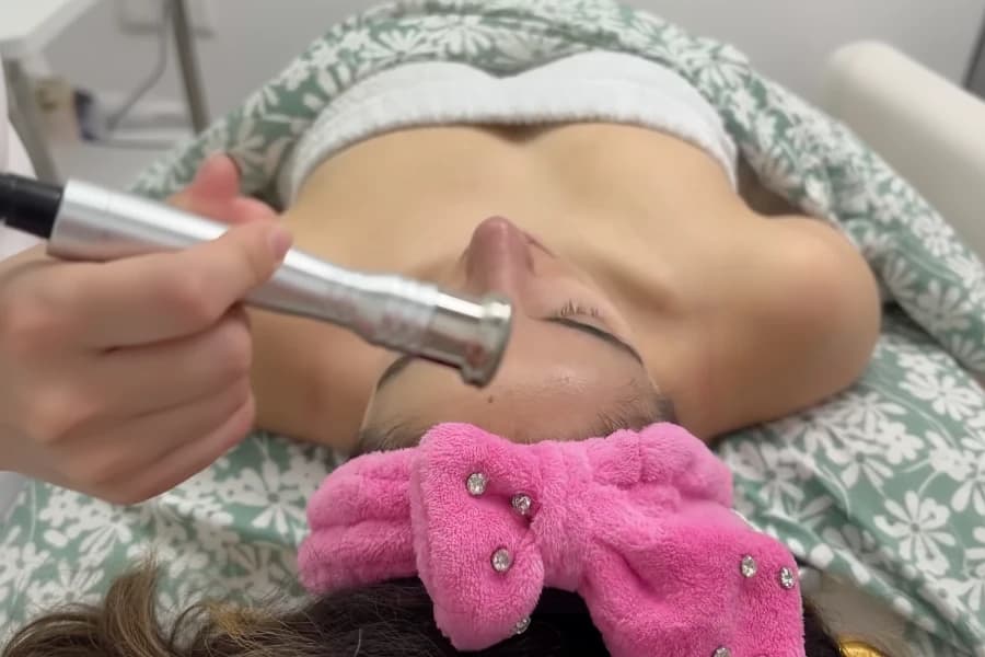 Diamond microdermabrasion facial treatment for skin exfoliation